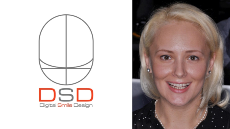 طراحی دیجیتالی لبخند DSD | لیزر دندانپزشکی اصفهان