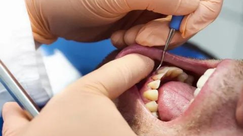 روشهای مختلف جراحی بیماری لثه | لیزر دندانپزشکی اصفهان