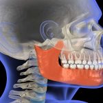 ارتباط بین TMJ و دندان عقل | لیزر دندانپزشکی اصفهان - طرح لبخند اصفهان | دکتر حسین برجیان