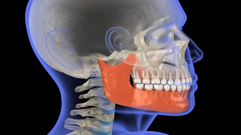 ارتباط بین TMJ و دندان عقل | لیزر دندانپزشکی اصفهان - طرح لبخند اصفهان | دکتر حسین برجیان