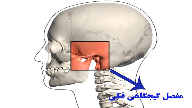 انواع اختلال عملکرد مفصل گیجگاهی فکی | لیزر دندانپزشکی اصفهان - طرح لبخند اصفهان | دکتر حسین برجیان