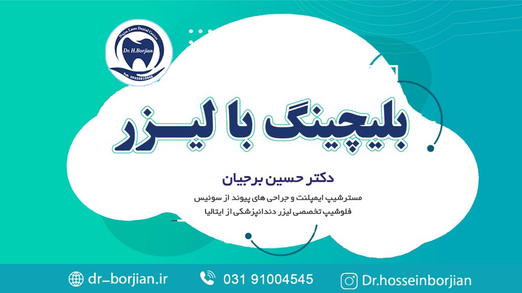 کلیپ آپارات بلیچینگ یا سفید کردن دندان با لیزر|لیزر دندانپزشکی اصفهان