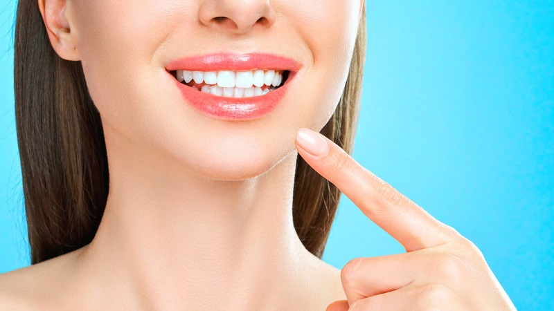 هزینه لیفت لثه چقدر است؟ | اصلاح طرح لبخند با جراحی لثه, اصلاح لبخند لثه‌ای, بلیچینگ دندان, بهترین دندانپزشک اصفهان, دکتر حسین برجیان, لیزر دندانپزشکی اصفهان