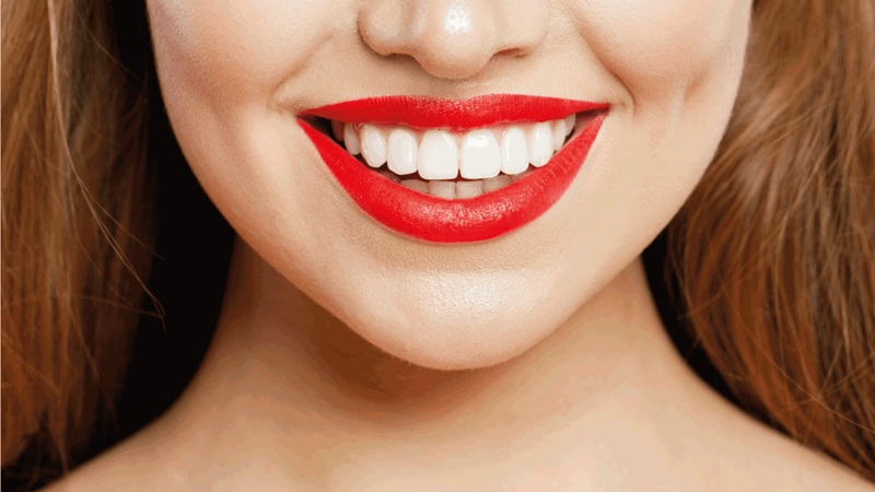 مدت زمان و مراحل انجام لیفت لثه | اصلاح طرح لبخند با جراحی لثه, اصلاح لبخند لثهای, بلیچینگ دندان, بهترین دندانپزشک اصفهان, دکتر حسین برجیان, لیزر دندانپزشکی اصفهان