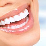 بلیچینگ دندان دو نوع اصلی دارد. | اصلاح طرح لبخند با جراحی لثه, اصلاح لبخند لثه‌ای, بلیچینگ دندان, بهترین دندانپزشک اصفهان, دکتر حسین برجیان, لیزر دندانپزشکی اصفهان