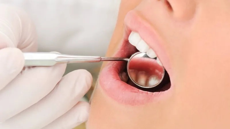برداشت ضایعات ناشی از ویروس HPV با روشی کم‌تهاجمی | لیزر دندانپزشکی اصفهان - طرح لبخند اصفهان | دکتر حسین برجیان
