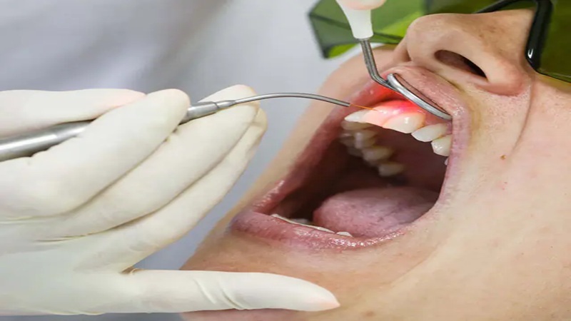 نقش لیزر در کاهش بار میکروبی و اصلاح پاسخ التهابی | لیزر دندانپزشکی اصفهان | طرح لبخند اصفهان | بلیچینگ دندان اصفهان | دکتر حسین برجیان